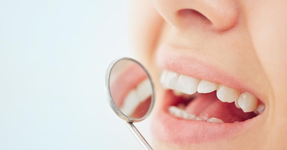 erosión dental causas y cómo evitarla